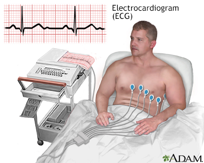 Electrocardiogram (ECG) Machine