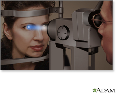 Slit-lamp exam