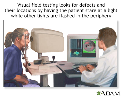 Visual field test - Illustration Thumbnail
              