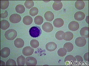 Red blood cells - normal