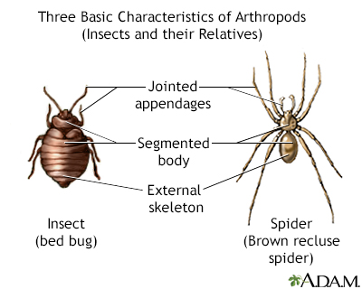 jumping spider bite treatment