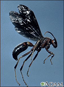 giant wasp sting
