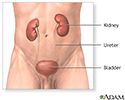 Kidney removal - series