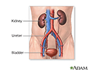 right hand presentation -                          Kidney transplant - series