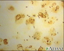 Legionnaires' disease organism, legionella