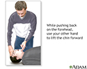 right hand presentation -                          CPR - adult - series