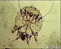 Scabies mite - photomicrograph