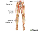 right hand presentation -                          Arterial bypass leg - series - Normal anatomy