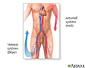 Venous thrombosis - series