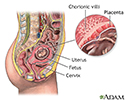right hand presentation -                          Chorionic villus sampling - normal anatomy
