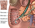 Biliary obstruction - series
