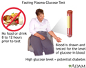 Fasting glucose tolerance test