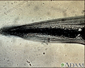 Pinworm, close-up of the head