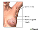 right hand presentation -                          Mastectomy - series - Normal anatomy