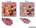 Changes in lung tissue with age