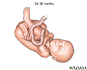 Fetus at 26 to 30 weeks