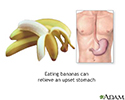 Bananas and nausea