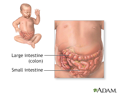Intestinal obstruction (pediatric) - series - Presentation Thumbnail
              