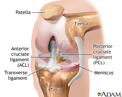 Dislocated knee torn deals ligaments