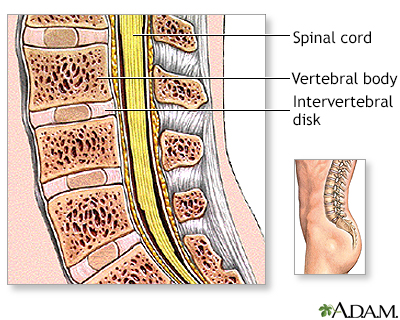 Lumbar spinal surgery  - series - Illustration Thumbnail
              