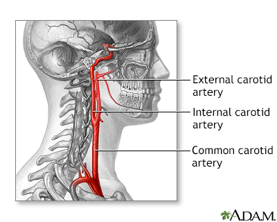 internal carotid artery in ear