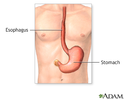 Gastrostomy tube placement - series - Presentation Thumbnail
              