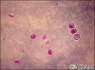 Cryptosporidium - organism - Illustration Thumbnail              