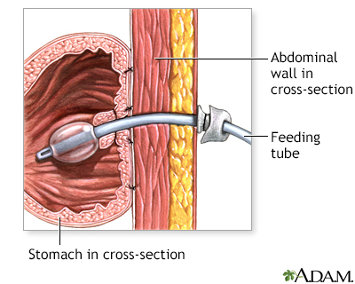 Procedure, part 1