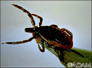 Tick, deer - adult female - Illustration Thumbnail
                      