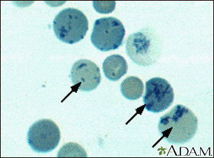 Reticulocytes - Illustration Thumbnail
                      