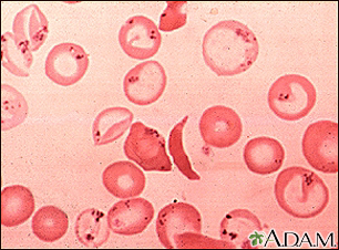 What do normal red blood cells look like?