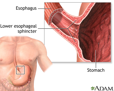 Achalasia - series - Presentation Thumbnail
                    