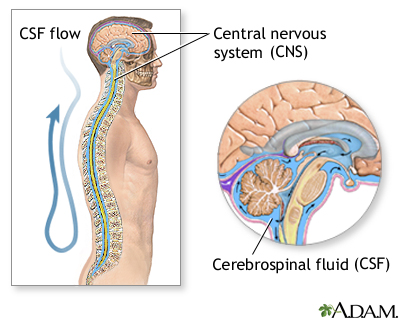 Cerebral Spinal Fluid (CSF) Shunt Systems