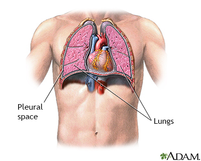 Pneumothorax - series - normal anatomy - Presentation Thumbnail
              