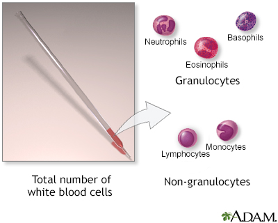 White blood cell count - series - Presentation Thumbnail
                    