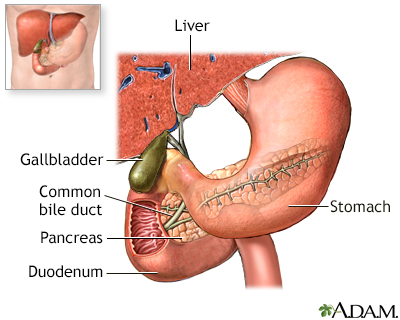 ERCP: What It Is, Why It's Done, Procedure & Complications