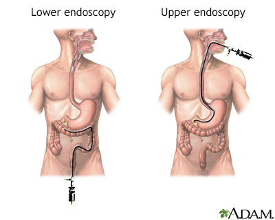 Procedure, part 1