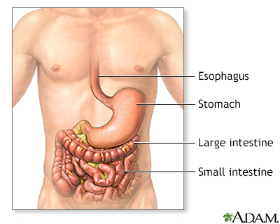 Crohn Disease Information