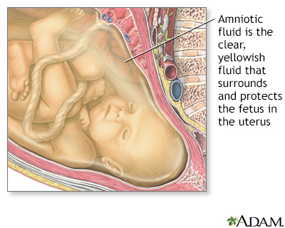 Do housework cry pump Amniotic fluid Information | Mount Sinai - New York