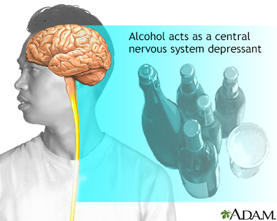 Alcohol use disorder - Illustration Thumbnail
                      