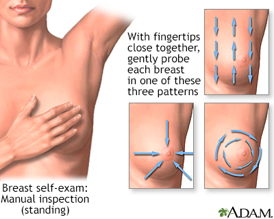 Breast self-exam Information