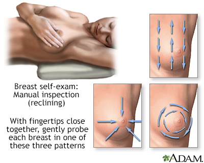 Auto-examen des seins
