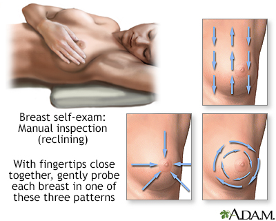 Breast self-exam - Illustration Thumbnail              