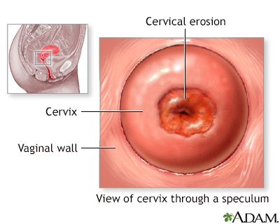 Pap smear test