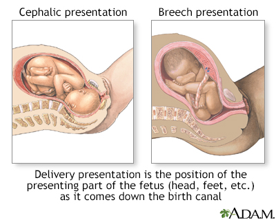 Your baby in the birth canal Information