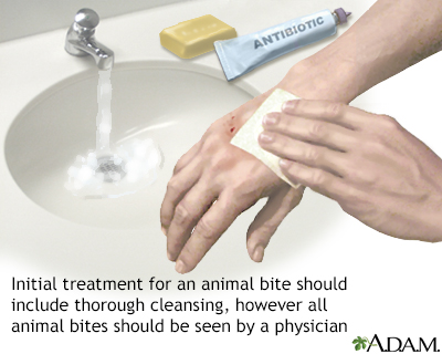 Animal bites - self-care Information | Mount Sinai - New York