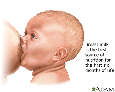 Overcoming breastfeeding problems Information