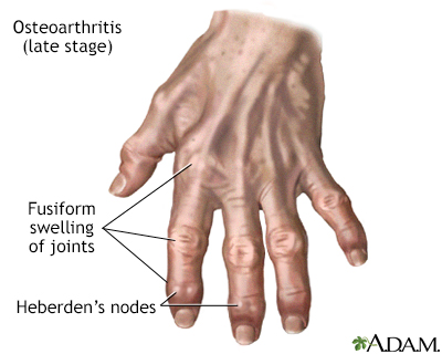 Aging changes in the bones - muscles - joints Information