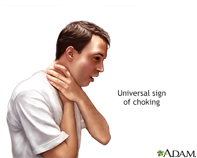 Choking - Presentation Thumbnail              