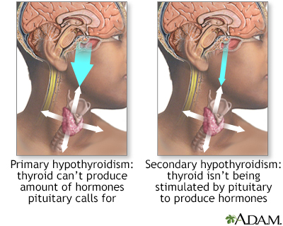 Primary and secondary hypothyroidism - Illustration Thumbnail
              